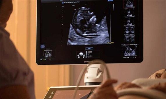 انجام سونوگرافی می‌تواند برای جنین مضر باشد؟