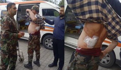 آخرین وضعیت حال جنگلبان گیلانی که توسط فرد محلی با سلاح سرد مجروح شد