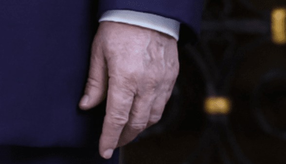 شایعات در مورد سلامتی ترامپ،‌ دوباره بالا گرفت