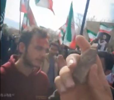 روایت دانشجوی مجروح از ایستادگی در برابر فتنه‌گری و اغتشاش