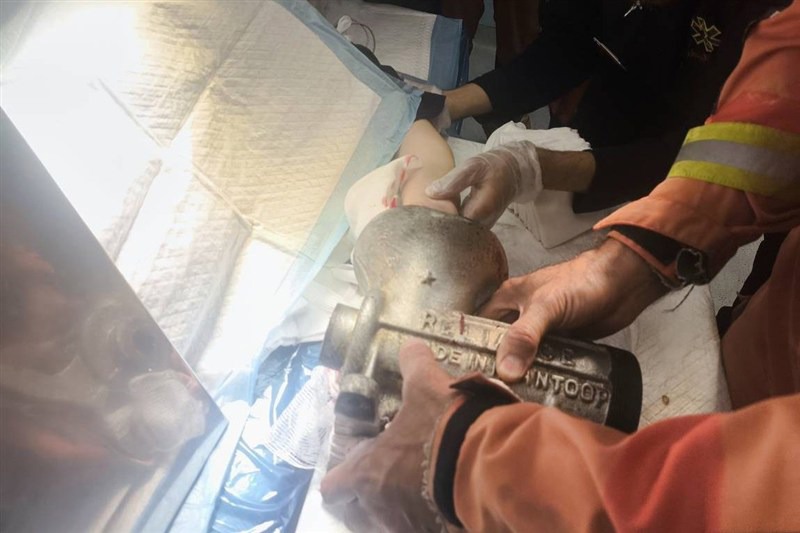 فاجعه در آشپزخانه؛ دست زن در چرخ‌گوشت له شد