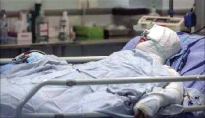 اسید پاشیدم چون می‌خواست به من تجاوز کند